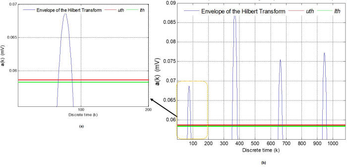 AdaptiveThreshold